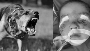 Đau lòng cháu bé 2 tuổi tử vong ngay đúng ngày sinh nhật vì bị chó dại cắn