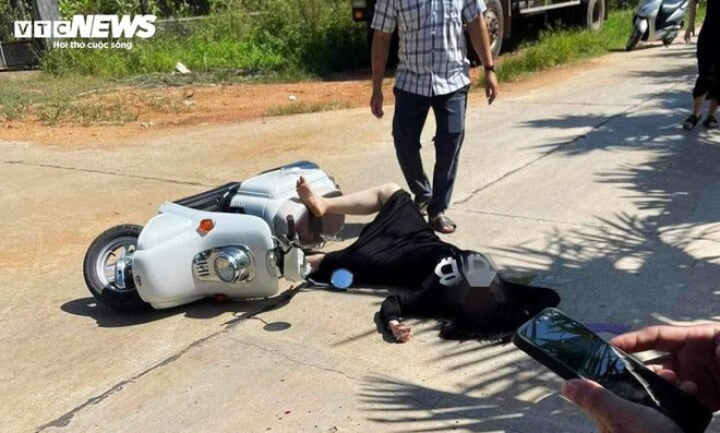 Một nữ trung tá công an huyện tại Bình Định bị đánh vỡ xương sọ - Ảnh 1.