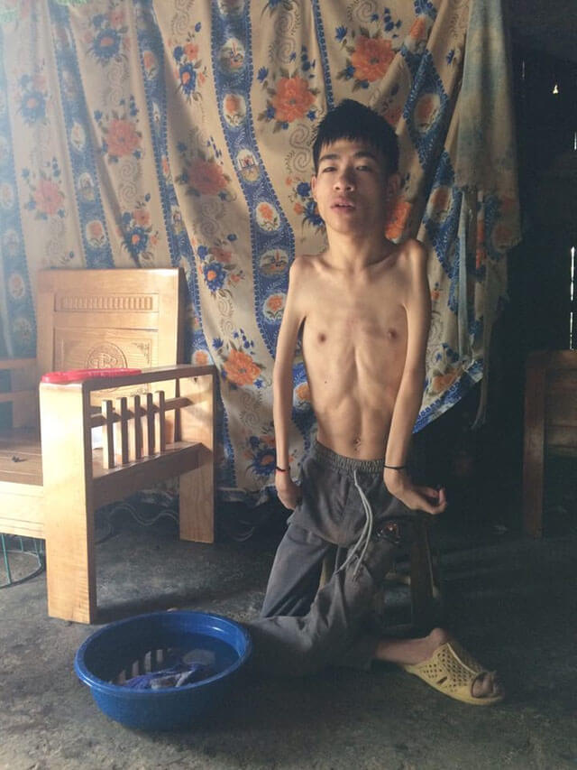 Bội phục game thủ khuyết tật Việt Nam vượt khó truyền cảm hứng đến cộng đồng